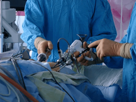 Műtéti beavatkozás